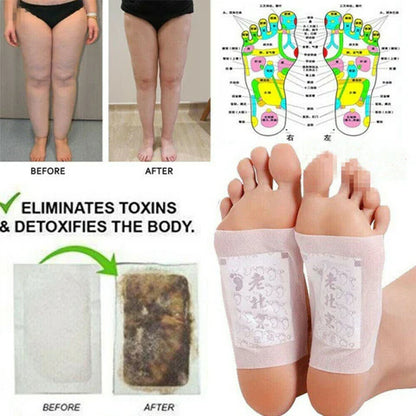 Natural Detox Foot Patches - 10-Piece Set for Restorative Cleansing